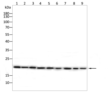 PTGDS Antibody