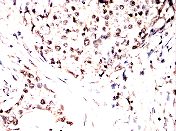 BAX Antibody