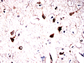 SLC6A1 Antibody