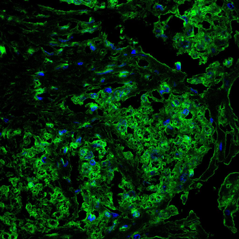 PAK2 Antibody