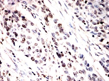 PAK2 Antibody