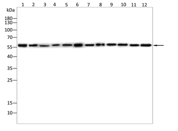PAK2 Antibody
