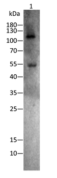 Acetyl Lysine antibody