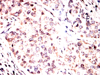 CDKN1B Antibody