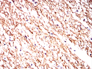 NFKBIB Antibody