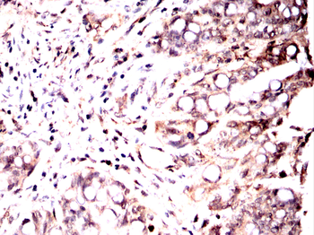 FOS Antibody