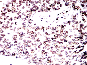 LMNB1 Antibody