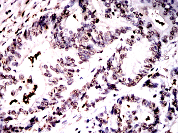 S100A8/S100A9 Antibody