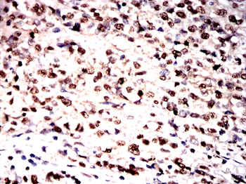 S100A8/S100A9 Antibody