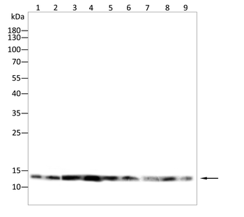 S100A8/S100A9 Antibody