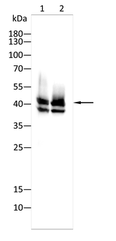 CD23 Mouse Monoclonal Antibody
