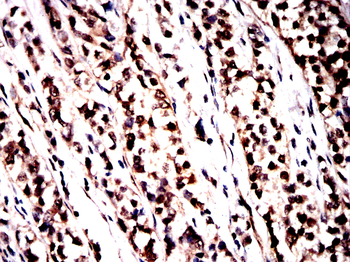 HSPA1A Antibody