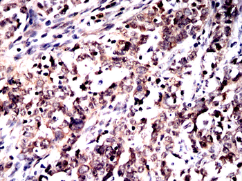 HSPA1A Antibody
