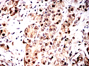 HSPA1A Antibody