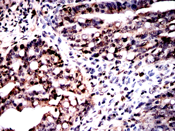 HSPA1A Antibody