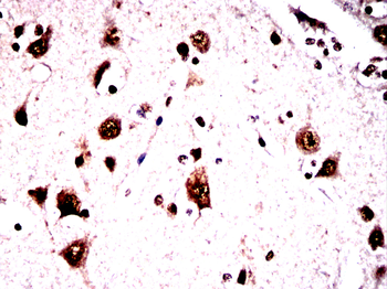 MAPT Antibody