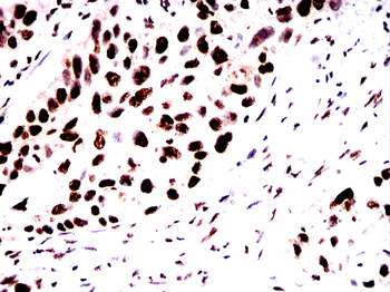 MAPT Antibody
