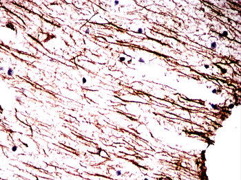 GFAP Mouse Monoclonal Antibody