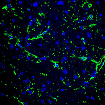 GFAP Mouse Monoclonal Antibody