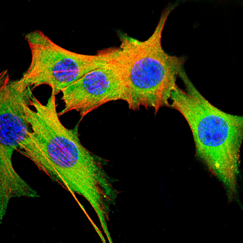 LGALS3 Antibody