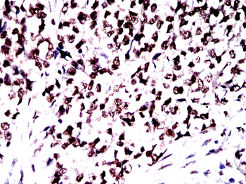 TBP Antibody