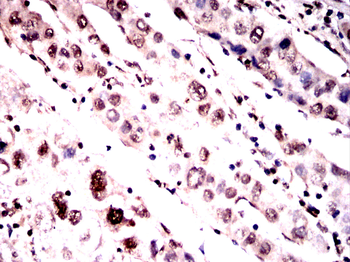 TBP Antibody