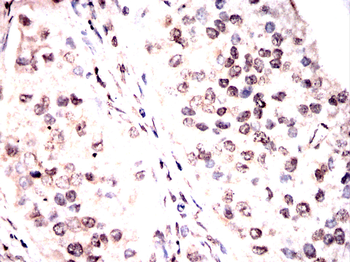 CTNNB1 Antibody