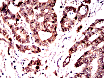 CTNNB1 Antibody