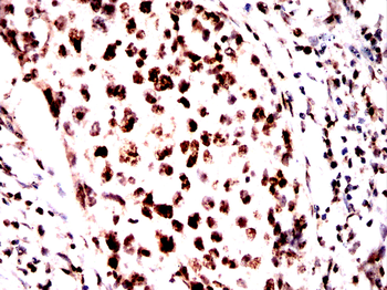 CBX5 Antibody