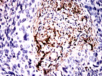 ACTA1 Antibody
