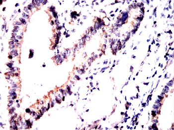 TUBA1B Antibody