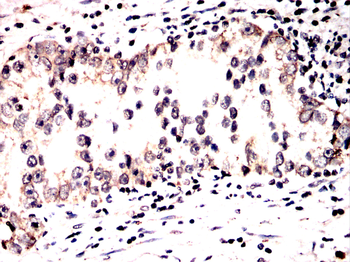 SMAD3 Antibody