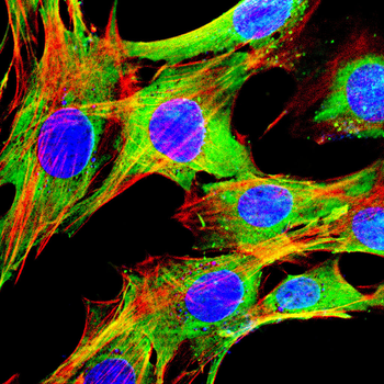UBB Antibody
