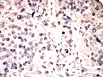 UBB Antibody