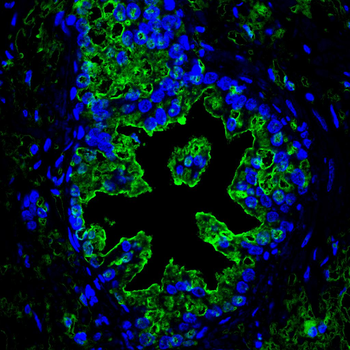 UBB Antibody