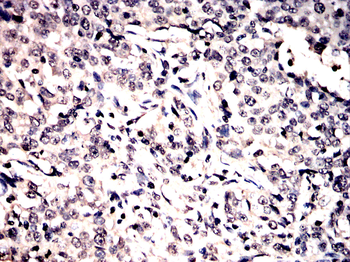 UBB Antibody
