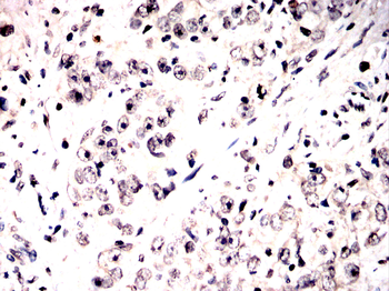 UBB Antibody