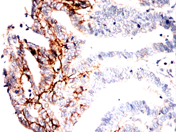 CA9 Antibody