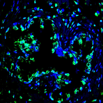 SPHK2 Antibody