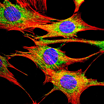 AMACR Antibody