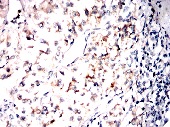 AMACR Antibody