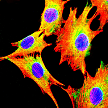 HSPB8 Antibody