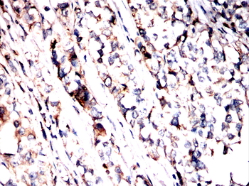 HSPB8 Antibody