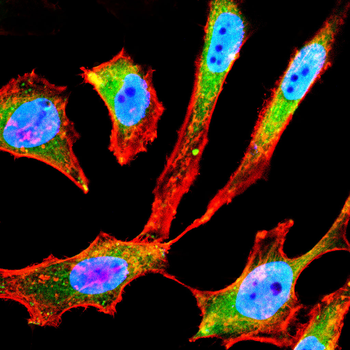 LCN2 Antibody