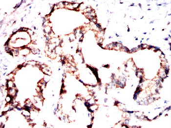 TFRC Antibody