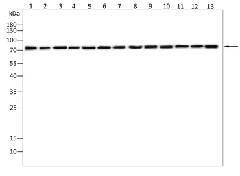 FOXP4 Rabbit Polyclonal Antibody