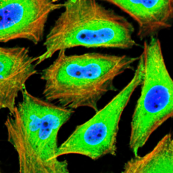 ACTN1 Antibody