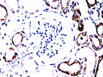 GRIN2B Antibody