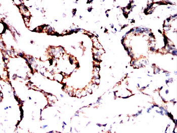 GRIN2B Antibody