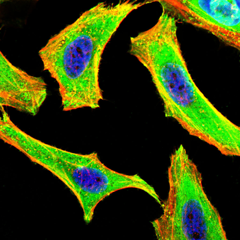 CXCL9/MIG Rabbit Polyclonal Antibody
